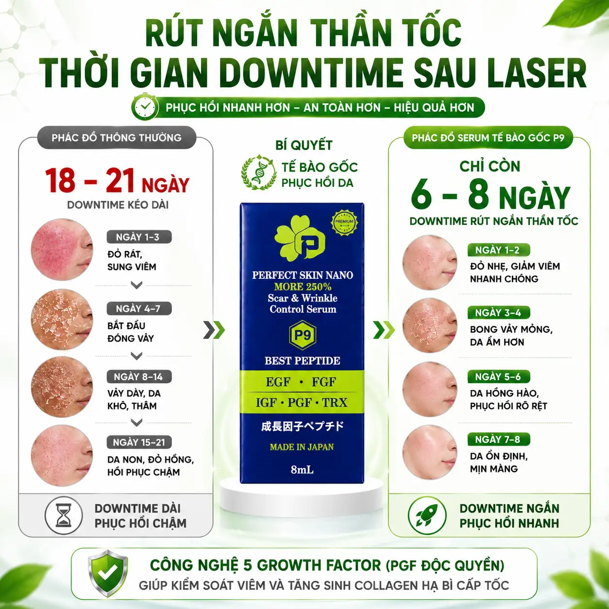 Bieu do minh hoa sau laser co2 phai lam gi de rut ngan downtime